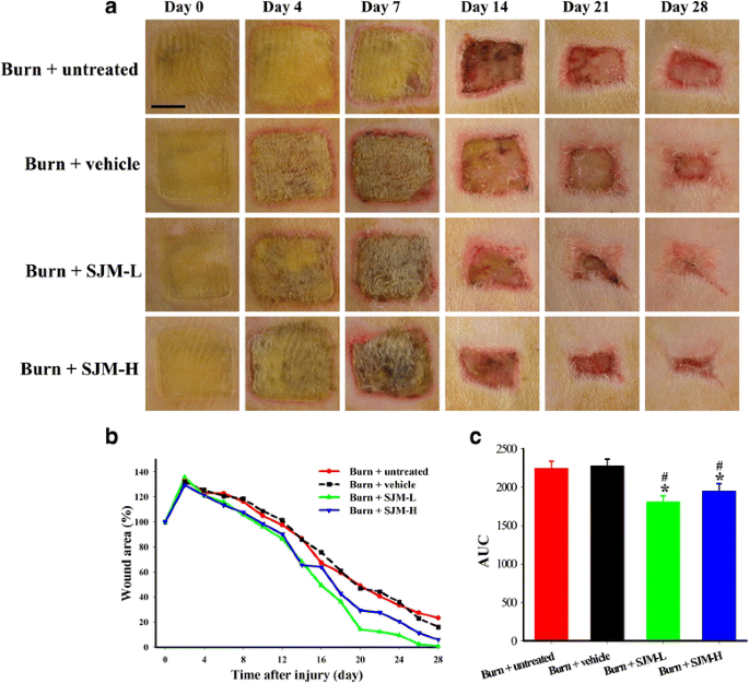 Anti-inflammatory and burn injury wound healing properties of the shell of  Haliotis diversicolor | BMC Complementary Medicine and Therapies | Full Text