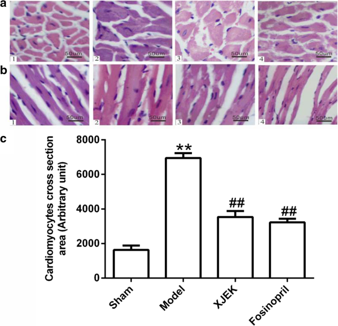 Protective effects of Xinji′erkang on myocardial infarction induced cardiac  injury in mice | BMC Complementary Medicine and Therapies | Full Text