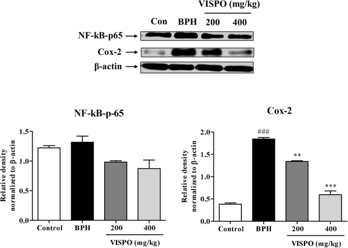 A phytosterol-enriched saw palmetto supercritical CO2 extract ameliorates  testosterone-induced benign prostatic hyperplasia by regulating the  inflammatory and apoptotic proteins in a rat model | BMC Complementary  Medicine and Therapies | Full Text