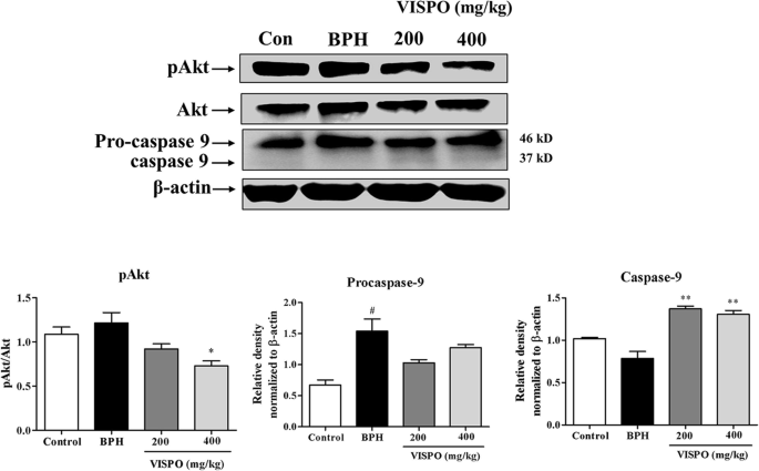 A phytosterol-enriched saw palmetto supercritical CO2 extract ameliorates  testosterone-induced benign prostatic hyperplasia by regulating the  inflammatory and apoptotic proteins in a rat model | BMC Complementary  Medicine and Therapies | Full Text