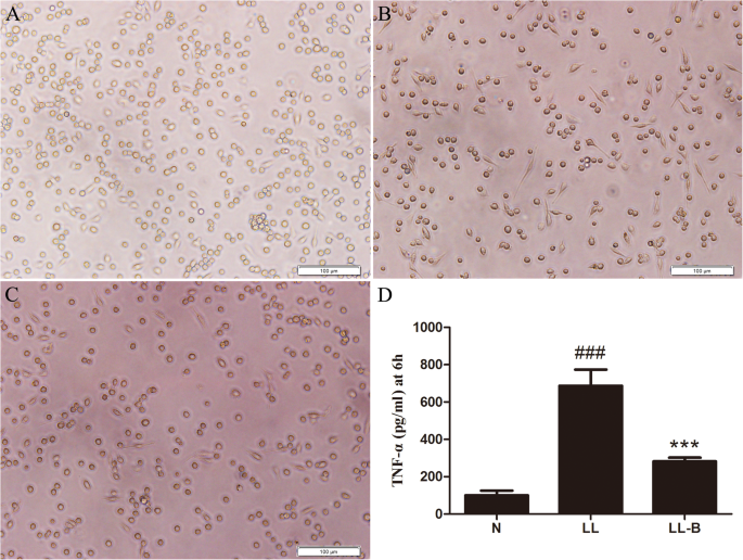 Inhibitory Effects Of Berberine On Proinflammatory M1 Macrophage Polarization Through Interfering With The Interaction Between Tlr4 And Myd Bmc Complementary Medicine And Therapies Full Text