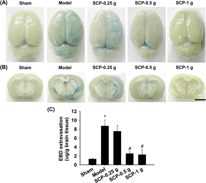 Acorus Tatarinowii Schott Extract Reduces Cerebral Edema Caused By Ischemia Reperfusion Injury In Rats Involvement In Regulation Of Astrocytic Nkcc1 Aqp4 And Jnk Inos Mediated Signaling Bmc Complementary Medicine And Therapies Full Text