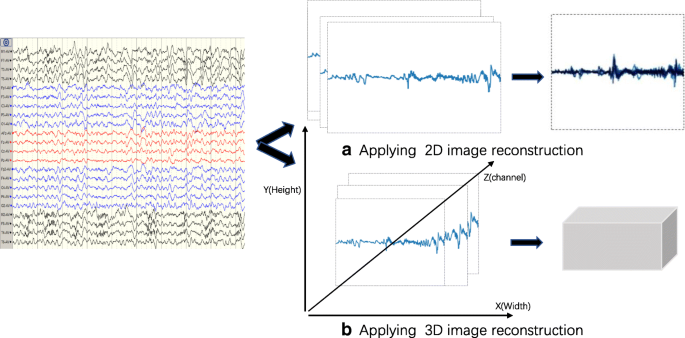 Automatic Seizure Detection Using Three Dimensional Cnn Based On Multi Channel Eeg Bmc Medical Informatics And Decision Making Full Text Automatic Seizure Detection Using Three Dimensional Cnn Based On Multi Channel Eeg Bmc Medical Informatics And Decision Making Full Text