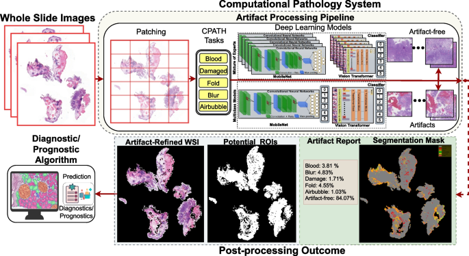 Equipping computational pathology systems with artifact processing 