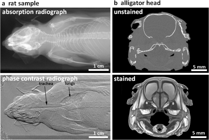 X Ray Computed Tomography In Life Sciences Bmc Biology Full Text