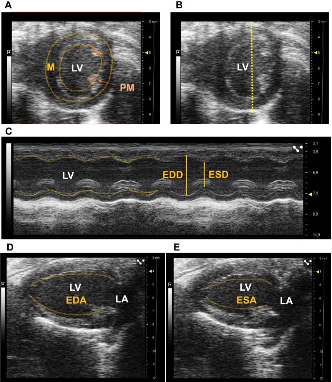 Non-invasive assessment of HFpEF in mouse models: current gaps and future  directions | BMC Medicine | Full Text