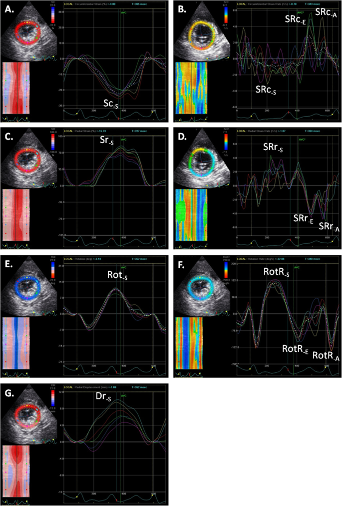 Variability among strain variables derived from two-dimensional speckle  tracking echocardiography in dogs by use of various software in: American  Journal of Veterinary Research Volume 80 Issue 4 ()