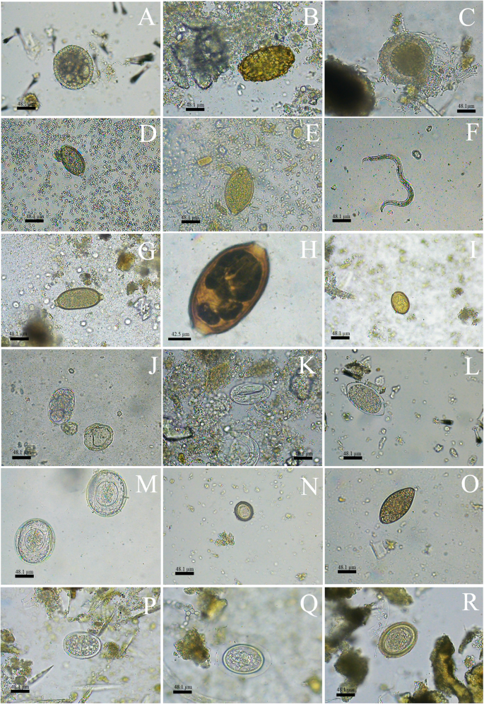 Helmint morfológia. Parazita a leveleken