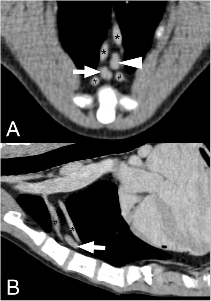 mediastinal lymph nodes in dogs