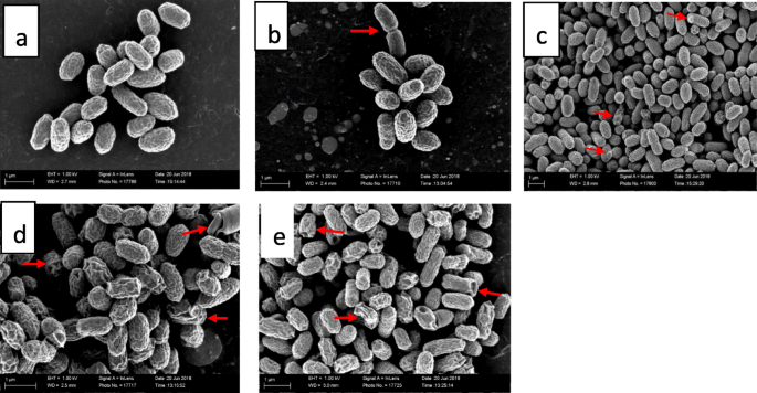 The Ultrastructural Damage Caused By Eugenia Zeyheri And Syzygium Legatii Acetone Leaf Extracts On Pathogenic Escherichia Coli Springerlink
