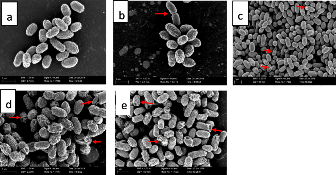 The Ultrastructural Damage Caused By Eugenia Zeyheri And Syzygium Legatii Acetone Leaf Extracts On Pathogenic Escherichia Coli Springerlink The Ultrastructural Damage Caused By Eugenia Zeyheri And Syzygium Legatii Acetone Leaf Extracts On Pathogenic Escherichia Coli Springerlink