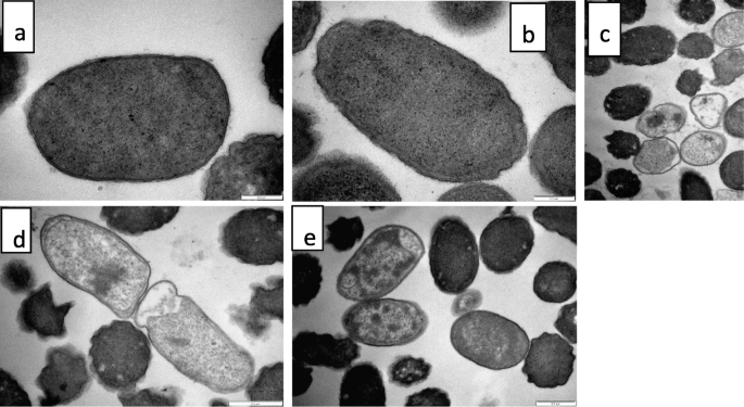 The ultrastructural damage caused by Eugenia zeyheri and Syzygium legatii  acetone leaf extracts on pathogenic Escherichia coli | BMC Veterinary  Research | Full Text