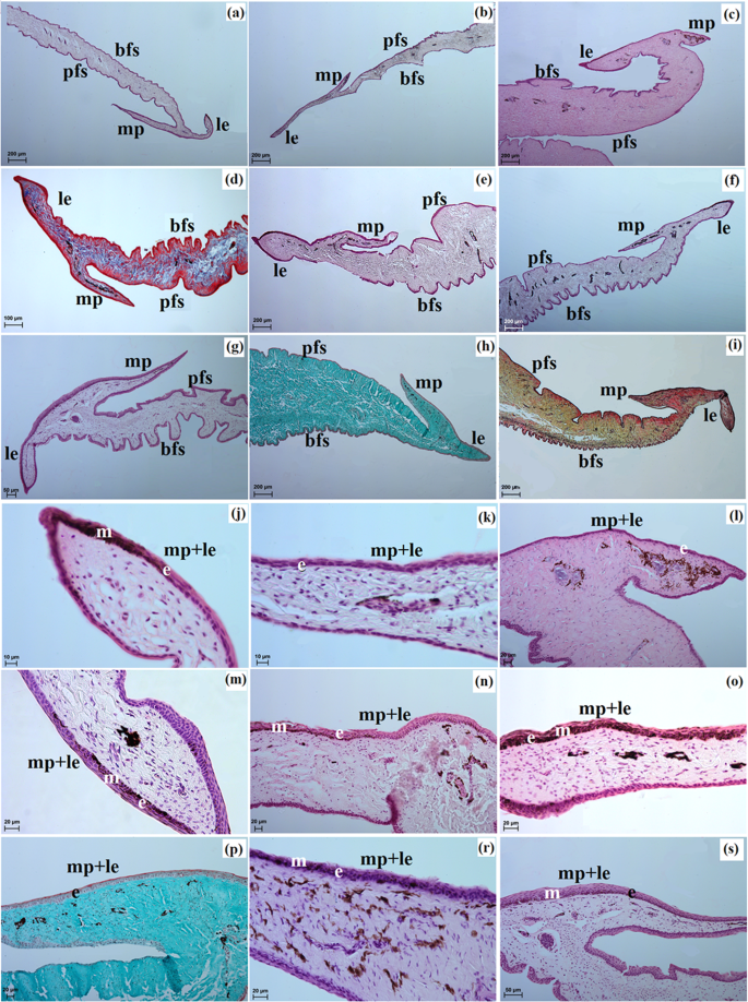 figure 15