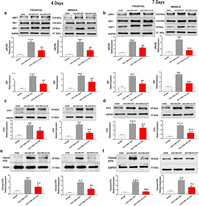 Granulocyte Colony Stimulating Factor Gene Therapy As A Novel Therapeutics For Stroke In A Mouse Model Journal Of Biomedical Science Full Text