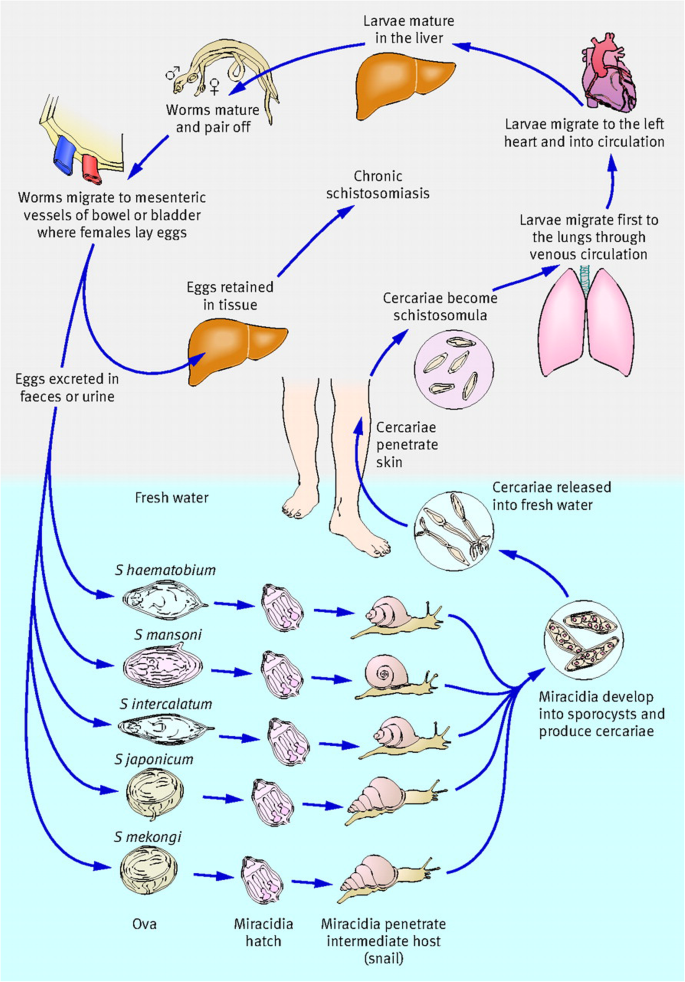 types of schistosomiasis cum se elimină virusul papiloma din corp