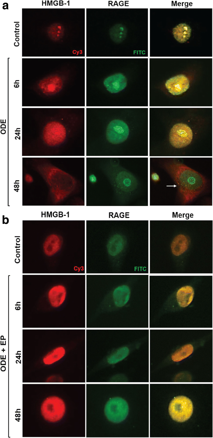 Ethyl Pyruvate Reduces Organic Dust Induced Airway Inflammation By Targeting Hmgb1 Rage Signaling Respiratory Research Full Text Ethyl Pyruvate Reduces Organic Dust Induced Airway Inflammation By Targeting Hmgb1 Rage Signaling Respiratory Research Full Text