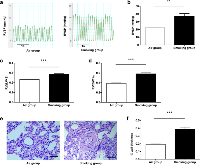 Role Of Rasef Hypermethylation In Cigarette Smoke Induced Pulmonary Arterial Smooth Muscle Remodeling Respiratory Research Full Text