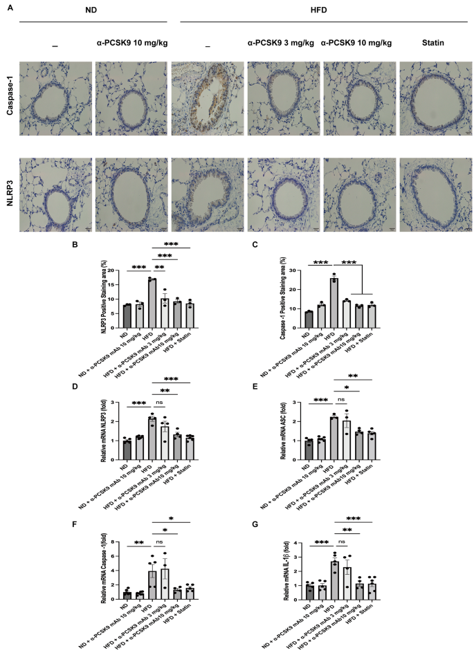 conditional gene expression in the respiratory epithelium of the mouse figure 6