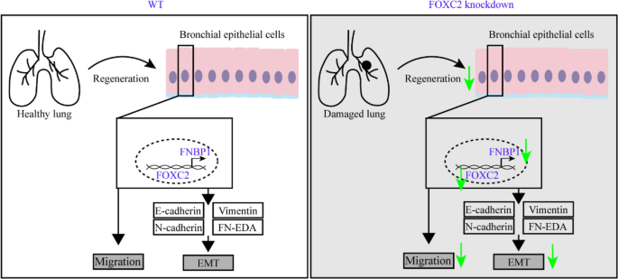 Modulation of the Epithelial–mesenchymal transition process by Forkhead ...