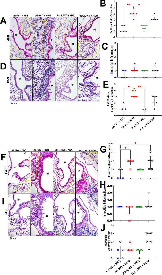 MMP12 deficiency attenuates menthol e-cigarette plus house dust-mite effects on pulmonary iron homeostasis and oxidative stress | Respiratory Research | Springer Nature Link MMP12 deficiency attenuates menthol e-cigarette plus house dust-mite effects on pulmonary iron homeostasis and oxidative stress | Respiratory Research | Springer Nature Link