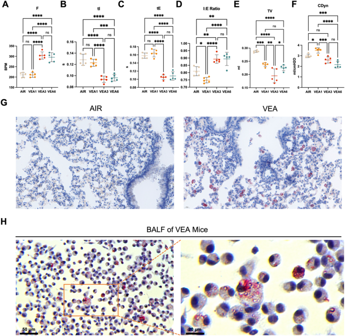A mouse model of E-cigarette or vaping product use-associated lung injury  (EVALI) induced by nose-only exposure to aerosolized vitamin E acetate and  associated macrophage dysfunction | Respiratory Research | Springer Nature  Link