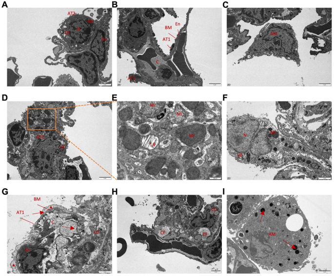 A mouse model of E-cigarette or vaping product use-associated lung injury  (EVALI) induced by nose-only exposure to aerosolized vitamin E acetate and  associated macrophage dysfunction | Respiratory Research | Springer Nature  Link