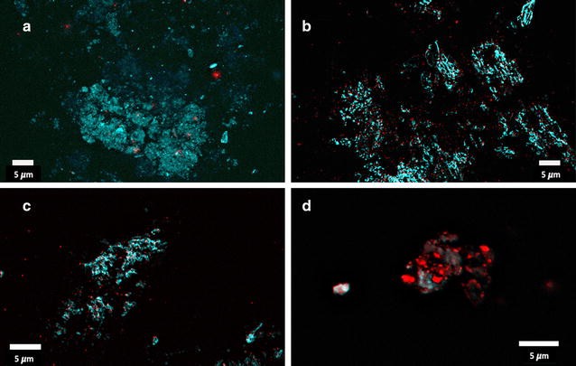 Substantial fibrin amyloidogenesis in type 2 diabetes assessed 