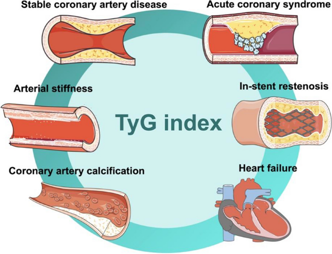 Association of the triglyceride and glucose index with low muscle