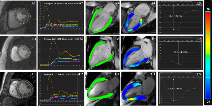 Left Ventricular Strain from Myocardial Perfusion PET Imaging