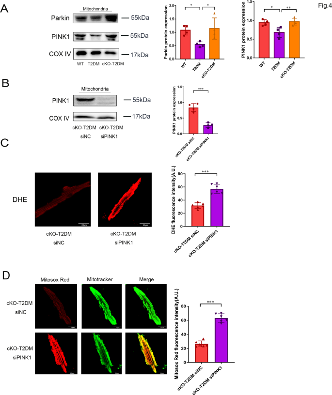 ZIP7 contributes to the pathogenesis of diabetic cardiomyopathy by 
