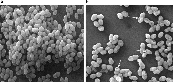 pix Salmonella Enterica Gram Stain microbial cell factories