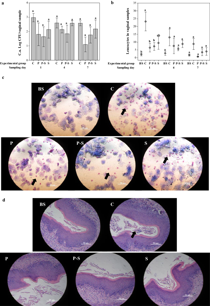 Biosurfactant from vaginal Lactobacillus crispatus BC1 as a promising agent  to interfere with Candida adhesion | Microbial Cell Factories | Full Text