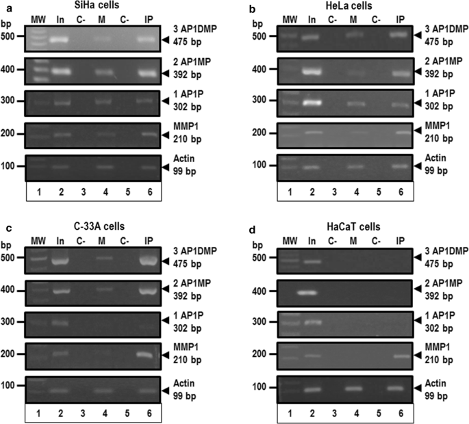 Transregulation of microRNA miR-21 promoter by AP-1 transcription ...