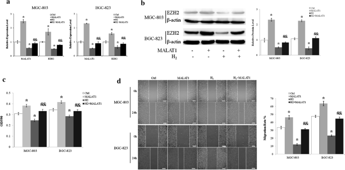 Wodór H2 hamuje proliferację i migrację komórek raka żołądka 4 rysunek 3