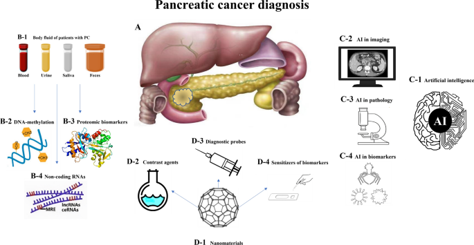 Pancreatic-Cancer-Causes-Symptoms-Diagnosis-Homeopathic-Allopathic-Treatment-Dr-Qaisar-Ahmed