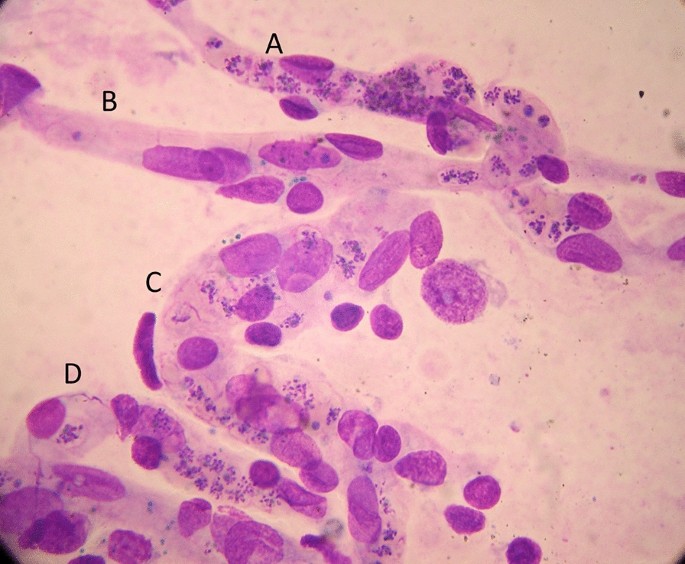 research paper on malaria pdf figure 5