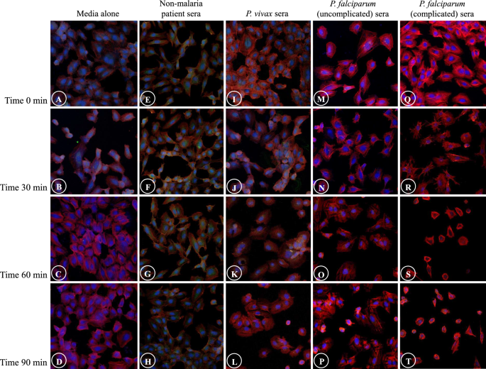 Immunofluorescence study of cytoskeleton in endothelial cells 