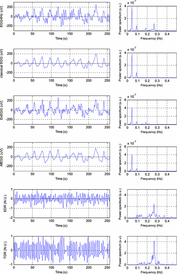 figure 15