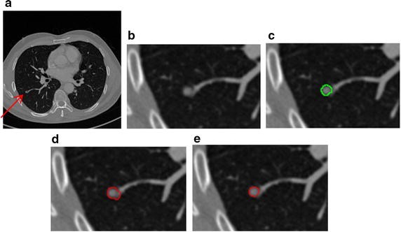 figure 14