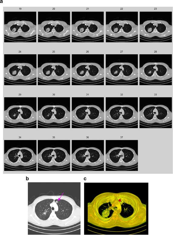 figure 17