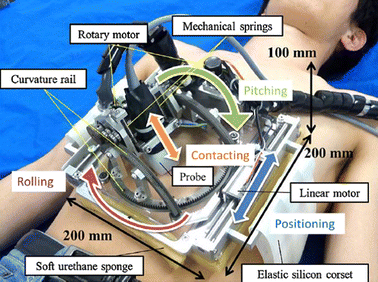 figure 14