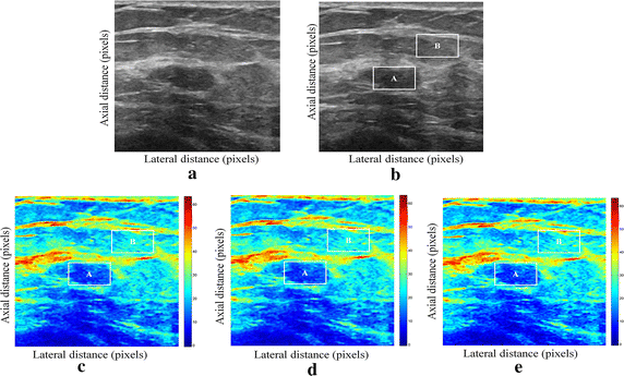 figure 15