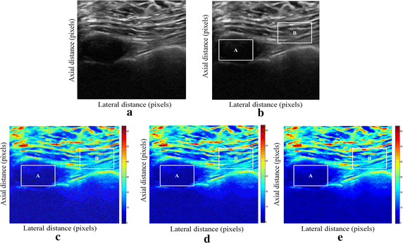 figure 22