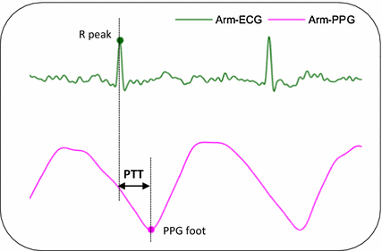 ecg ppg blood pressure