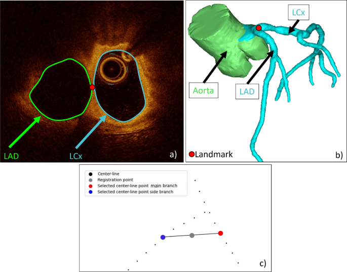 Ccta Device Guide A comprehensive workflow for CCTA and OCT data fusion with 3D printing ...