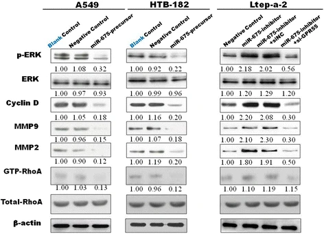 GPR55 in non-small cell lung cancer | Molecular Cancer Down-regulation of miR-675-5p contributes to tumor progression and... 
