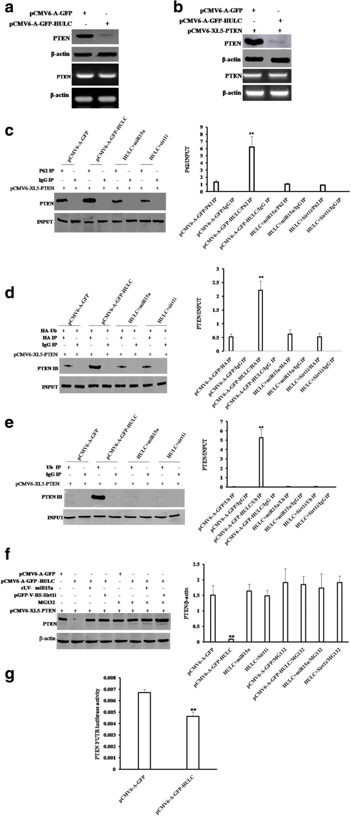 Long Noncoding Rna Hulc Accelerates Liver Cancer By Inhibiting Pten Via Autophagy Cooperation To Mir15a Molecular Cancer Full Text