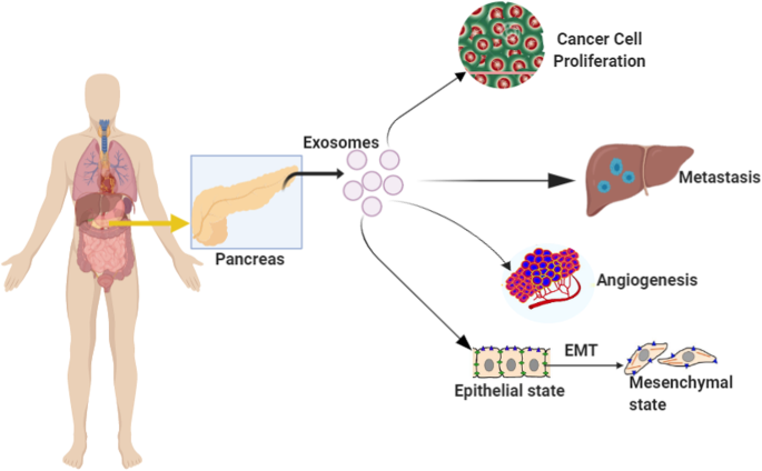 Tratamentul cancerului pancreatic și al căilor biliare - Protoni din California