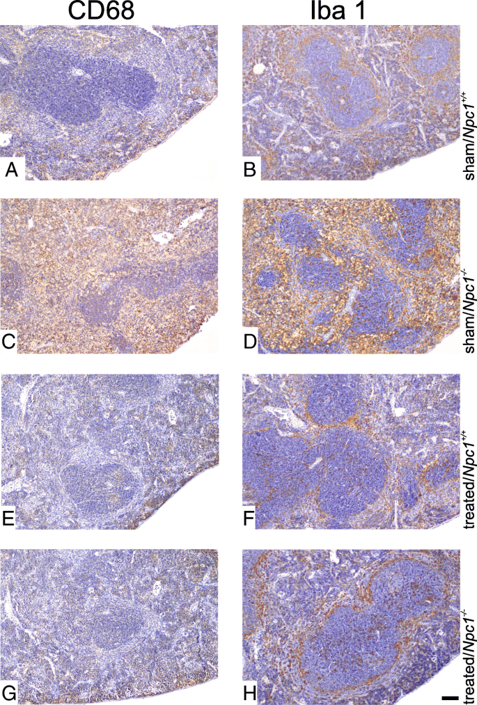 A therapy with miglustat, 2-hydroxypropyl-ß-cyclodextrin and  allopregnanolone restores splenic cholesterol homeostasis in Niemann-pick  disease type C1 | Lipids in Health and Disease | Full Text