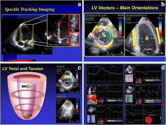 Speckle Tracking Echocardiography - an overview